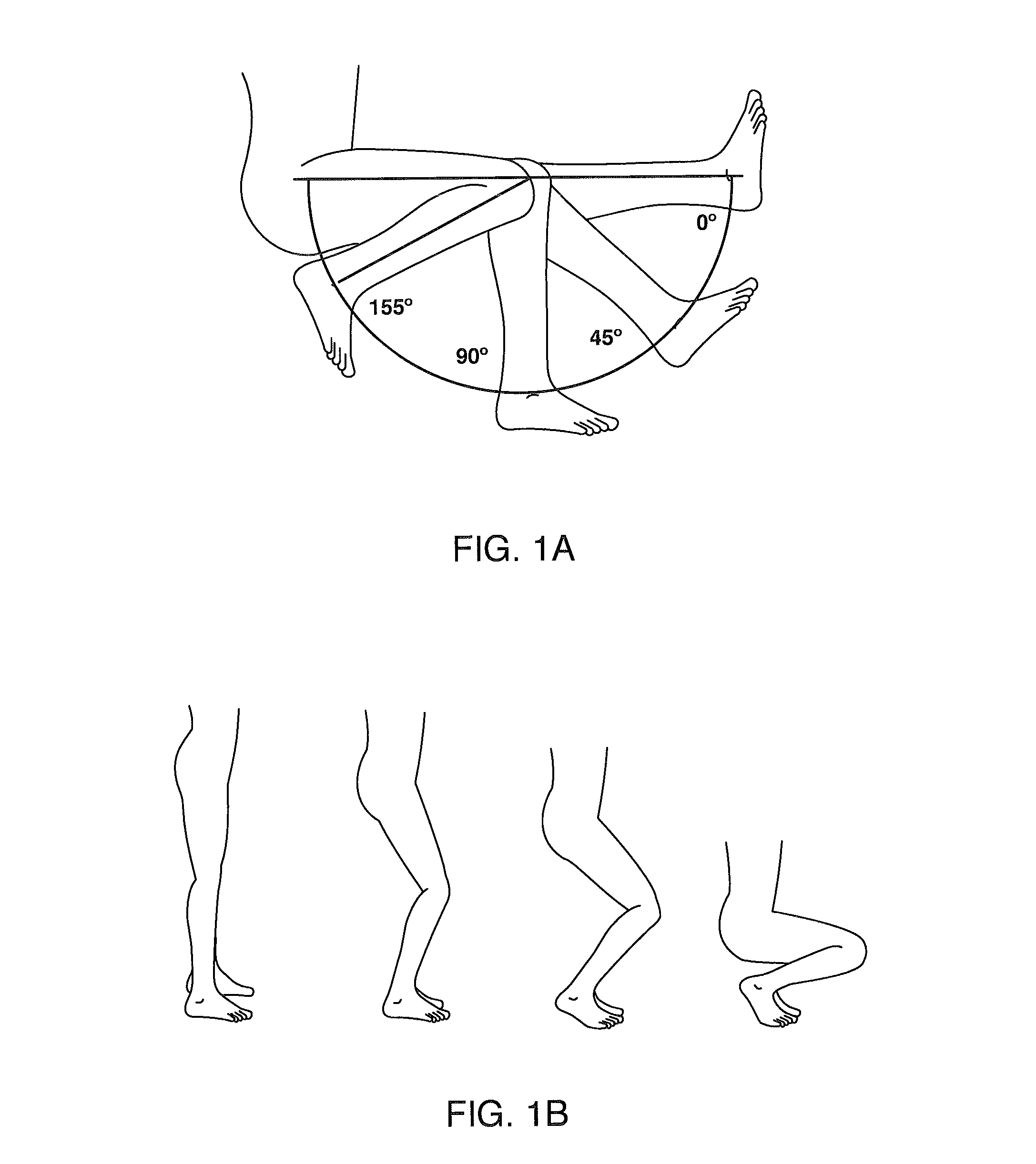 Systems and methods for providing a modular femoral component