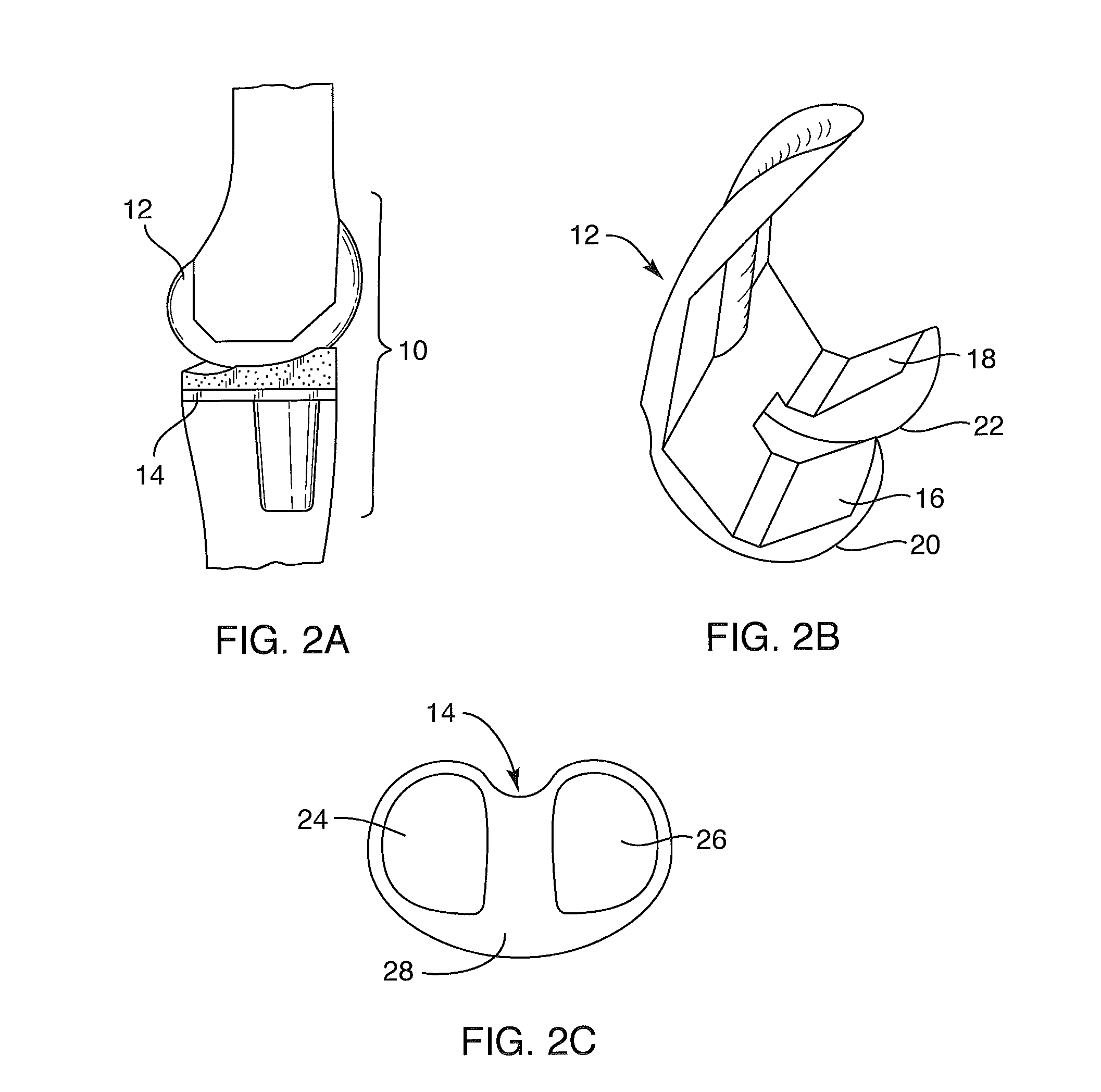 Systems and methods for providing a modular femoral component