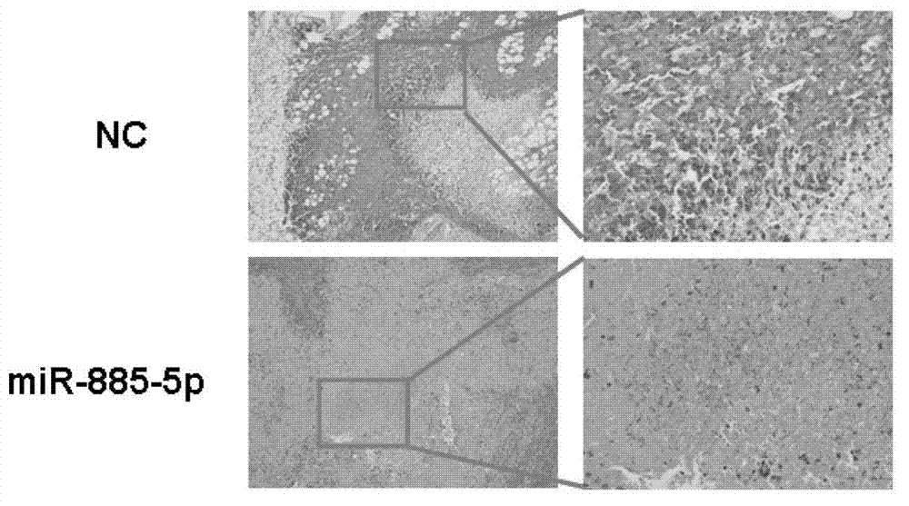 Novel method for inhibiting primary liver cancer growth and metastasis