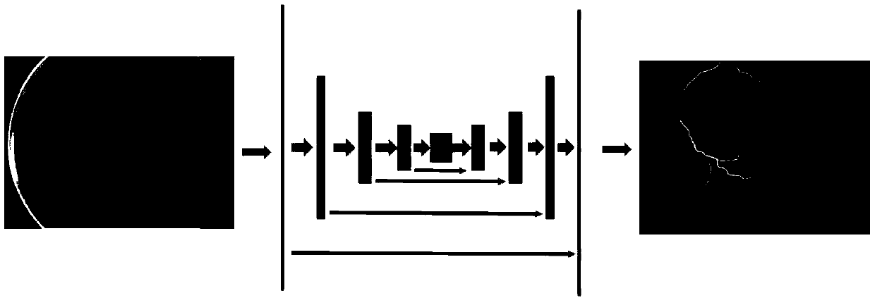 Premature infant retinopathy plus lesion classification method