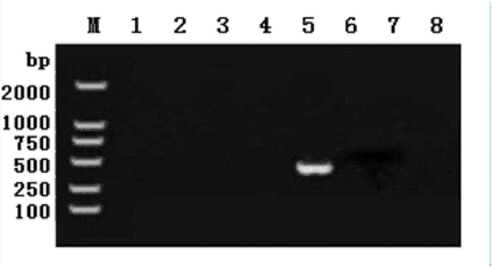 Specific primer for detecting pig metastrongylus elongatus and application thereof