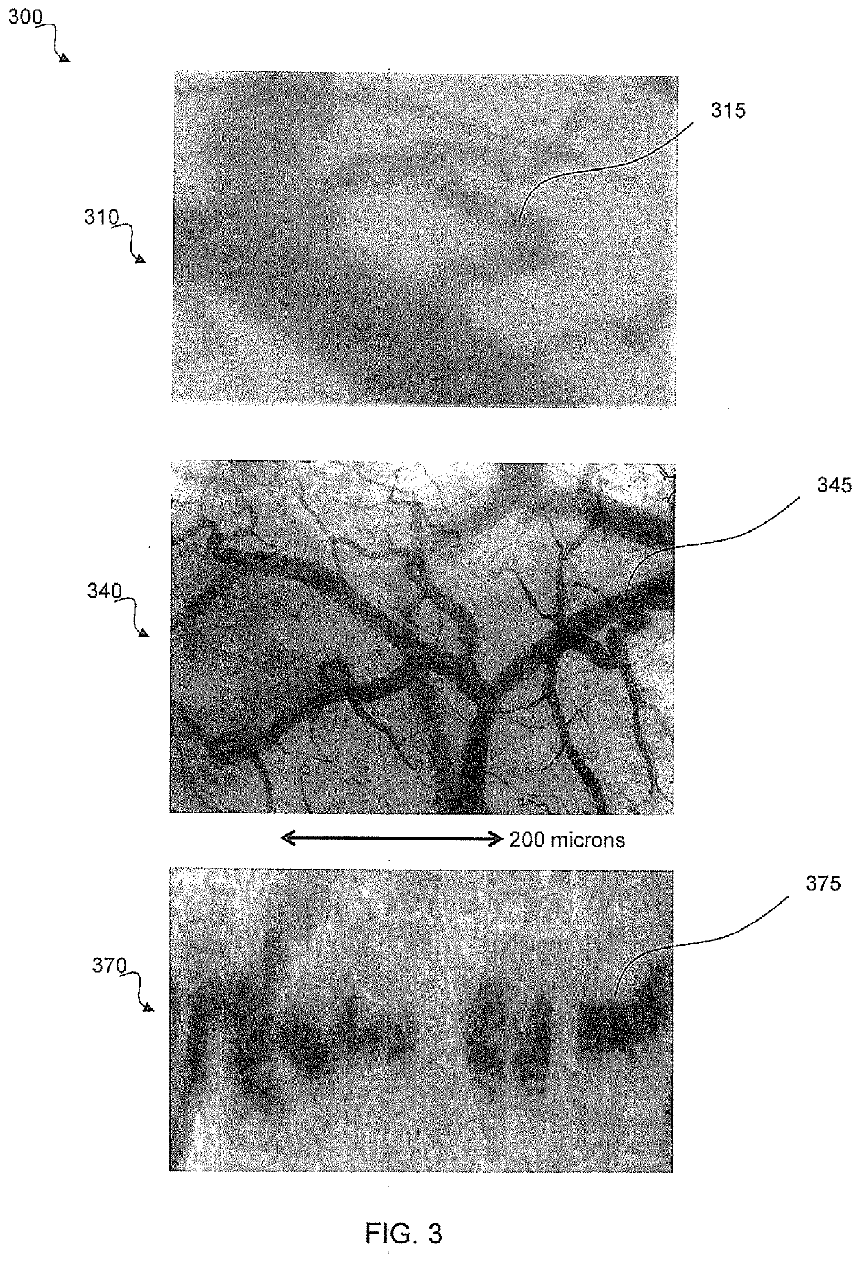 Method and apparatus for diagnostic analysis of the function and morphology of microcirculation alterations