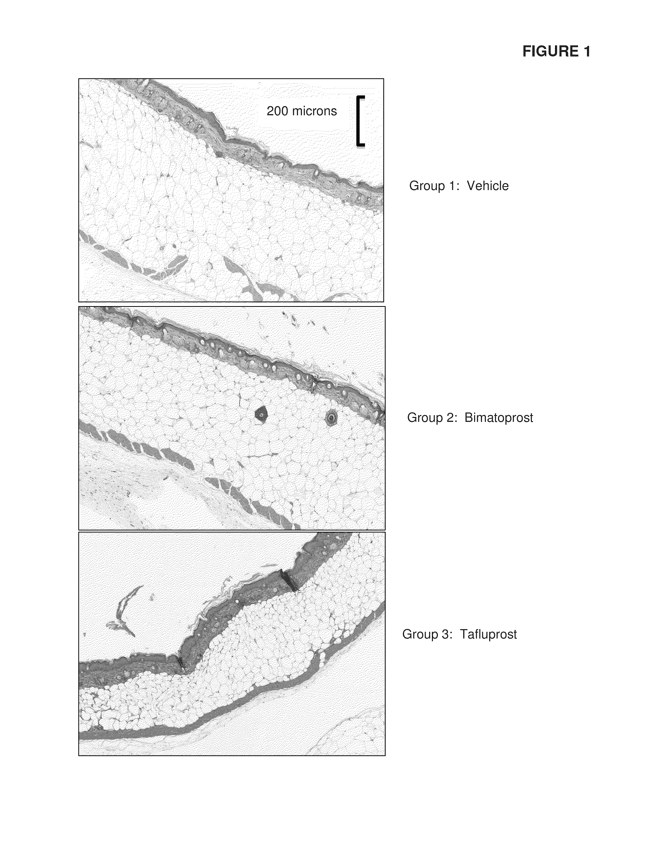 Methods and compositions for reducing body fat and adipocytes
