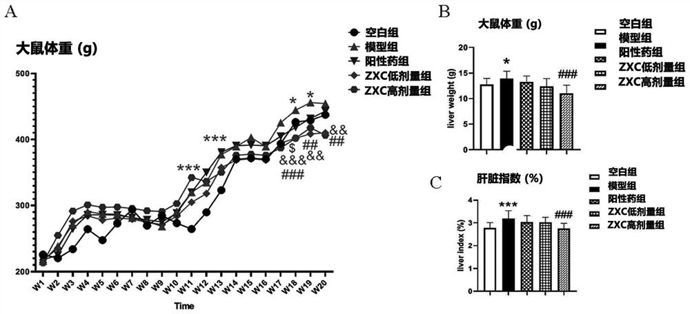 The Medical Application of Zhixiong Capsules in Treating Nonalcoholic Fatty Liver Disease
