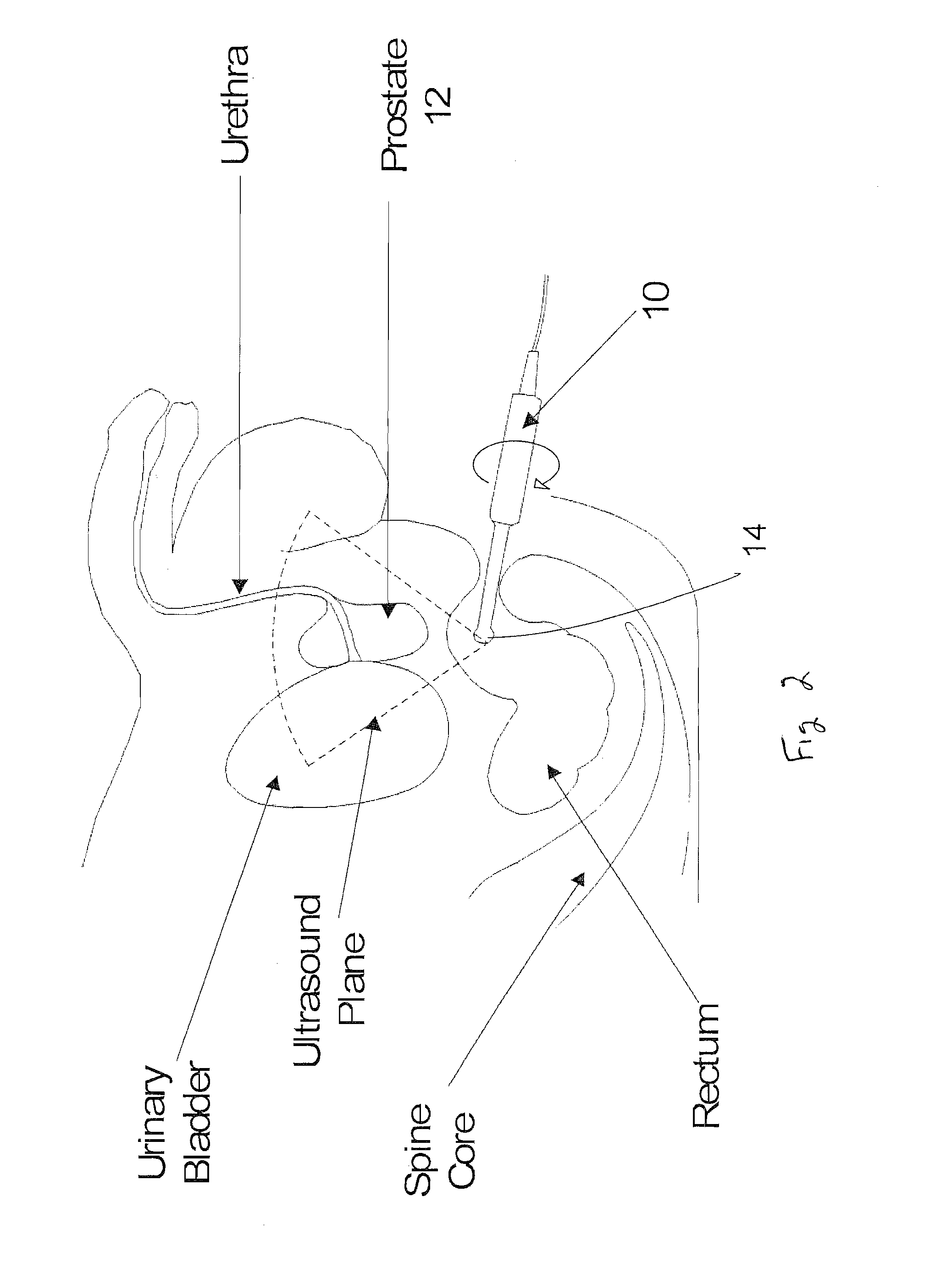 System and method for 3-d biopsy
