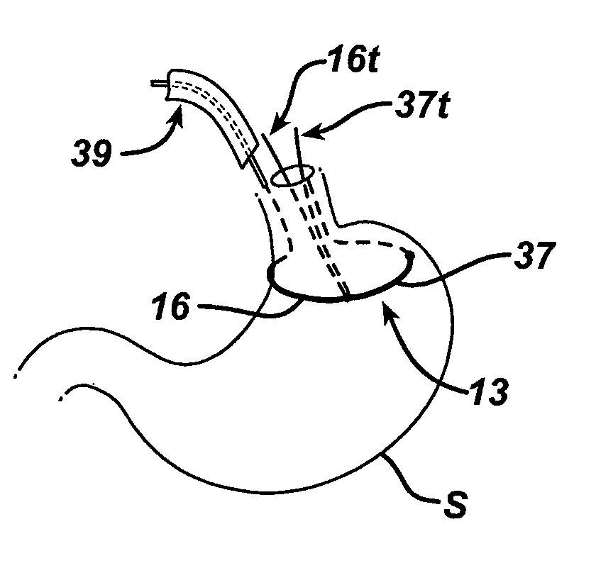 Methods and devices for providing direction to surgical tools