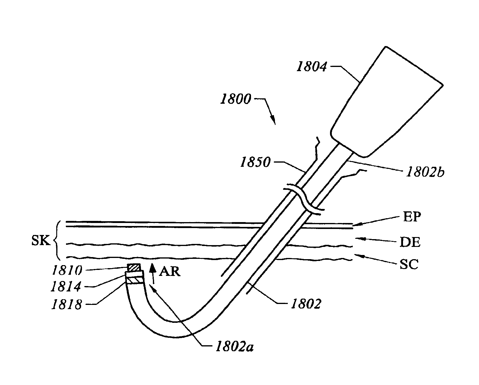 Methods and apparatus for skin treatment