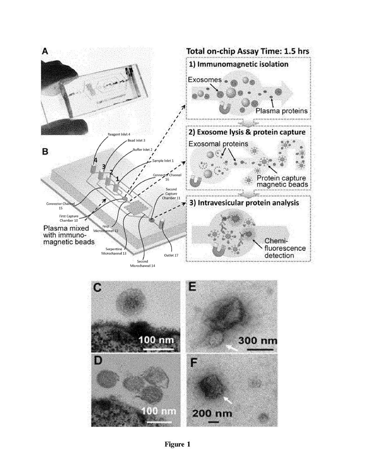 Non-invasive monitoring cancer using integrated microfluidic profiling of circulating microvesicles