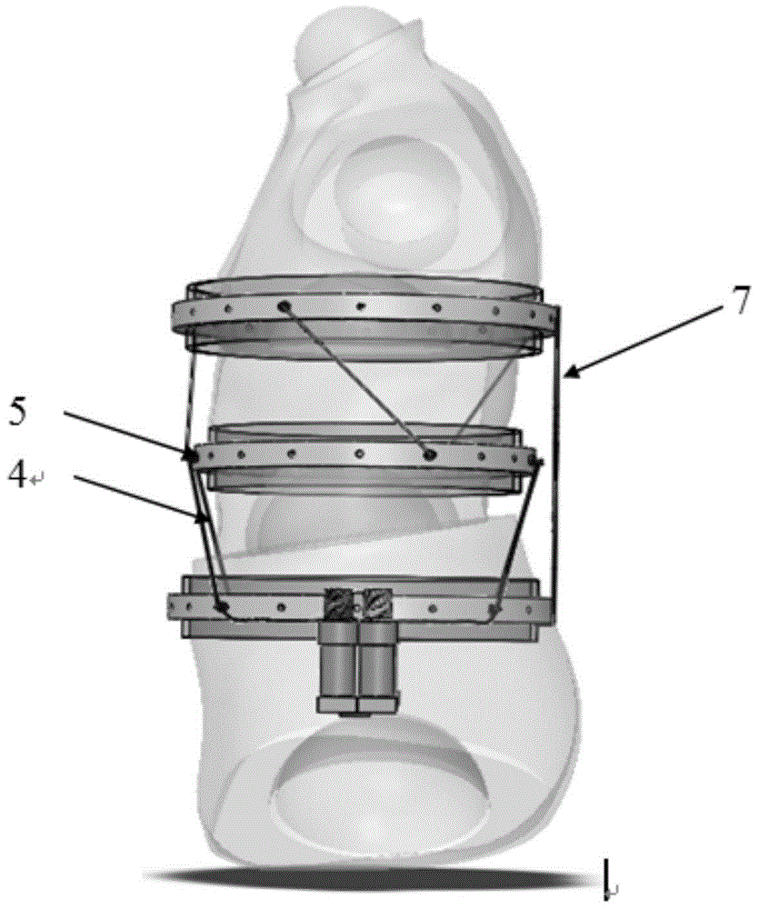 A rope-type scoliosis rehabilitation medical robot