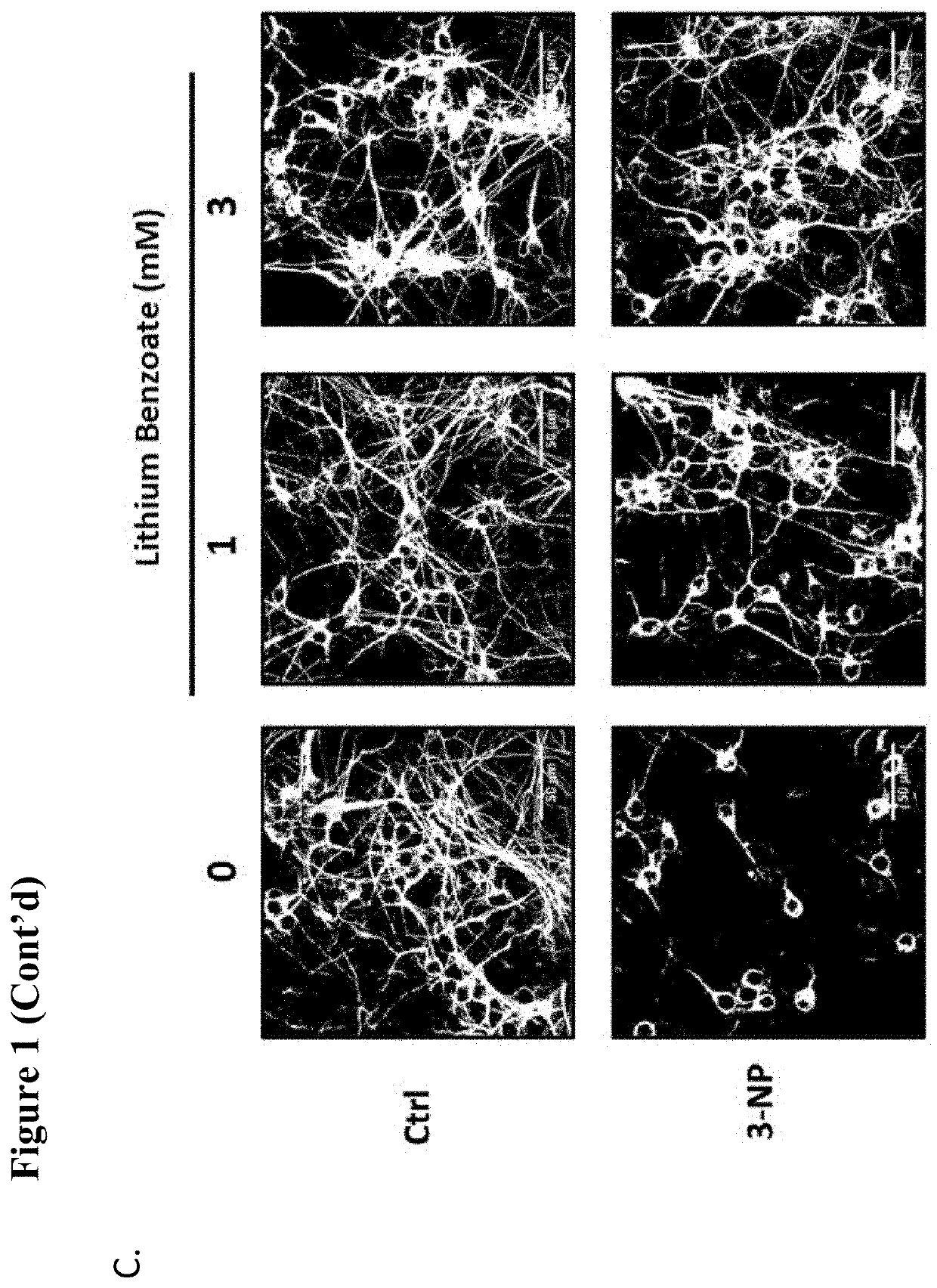 Use of lithium benzoate for treating central nervous system disorders