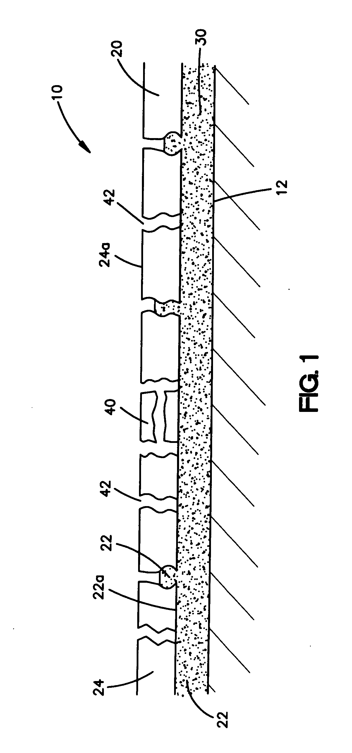 Coatings for medical devices comprising a therapeutic agent and a metallic material