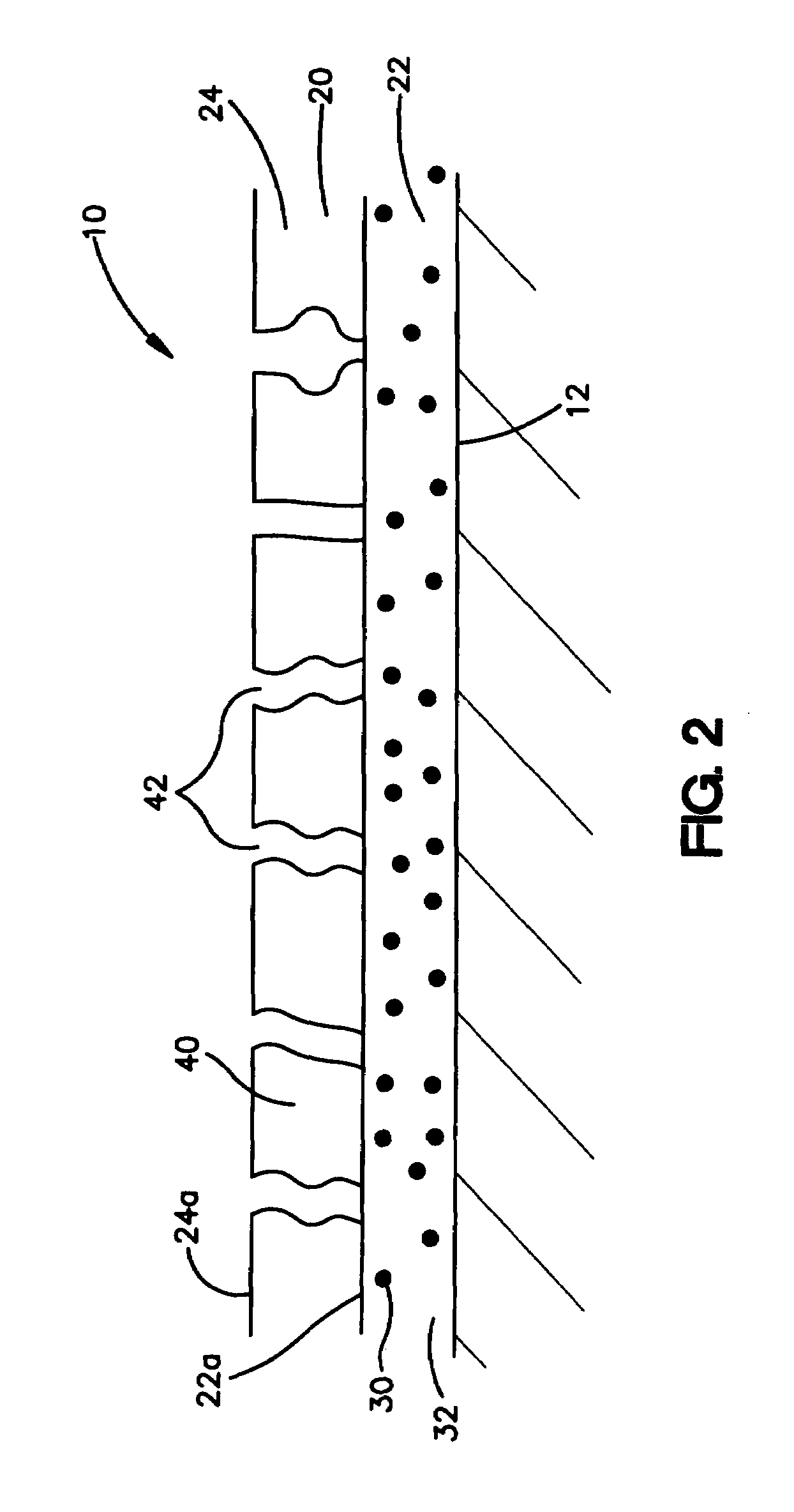 Coatings for medical devices comprising a therapeutic agent and a metallic material