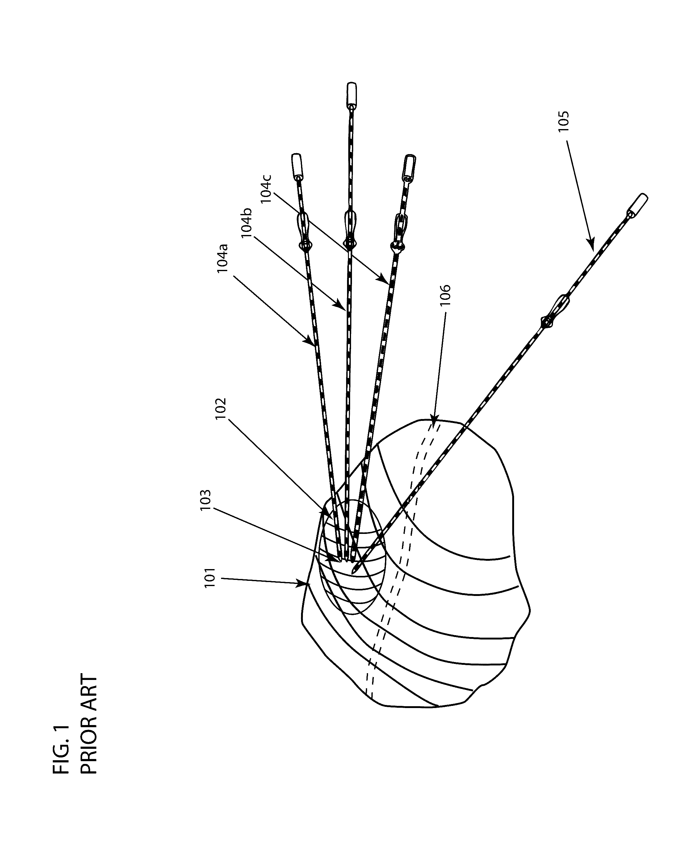 Systems, methods, and devices for assisting or performing guided interventional procedures using custom templates
