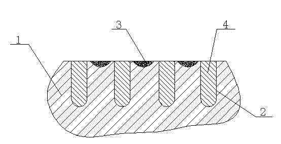 Novel squeeze roller type roller surface structure