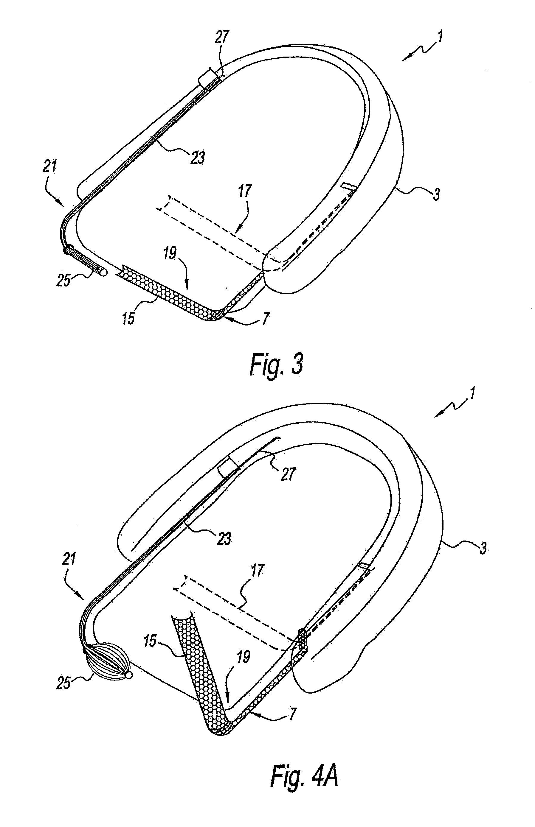 Devices, systems and methods for the treatment of sleep apnea