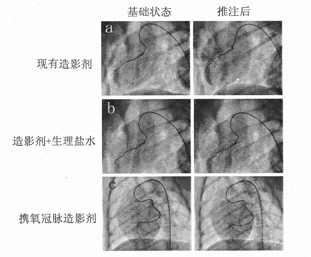 Oxygen carrying coronary contrast medium and preparation method thereof