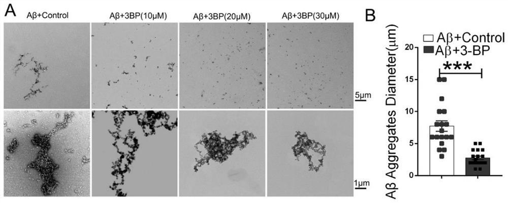 Use of hexokinase inhibitors in the preparation of drugs for preventing and/or treating Alzheimer's disease