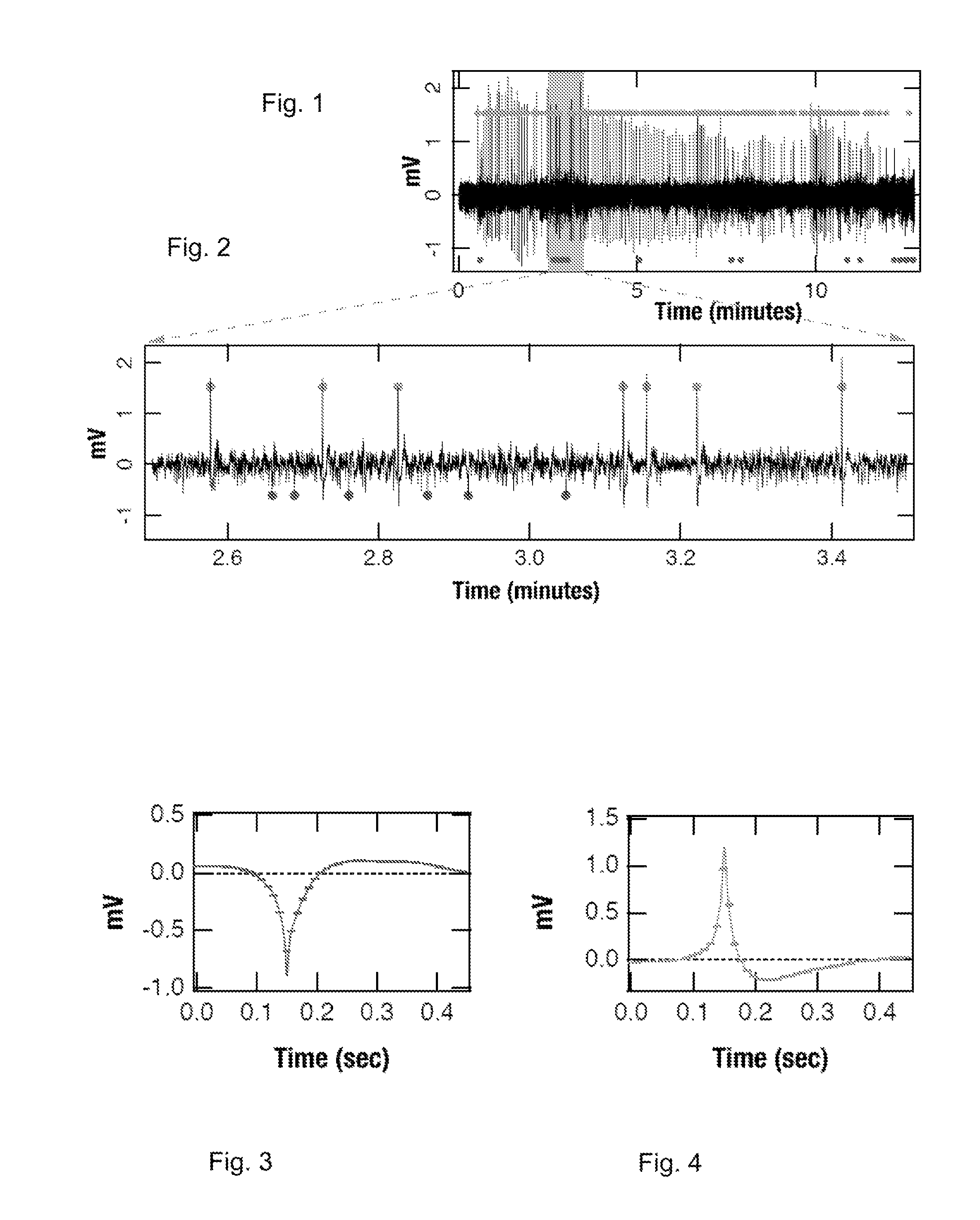Method and system for detecting epileptogenesis