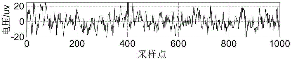 EEG Signal Denoising Method Based on Double Density Wavelet Neighborhood Correlation Thresholding