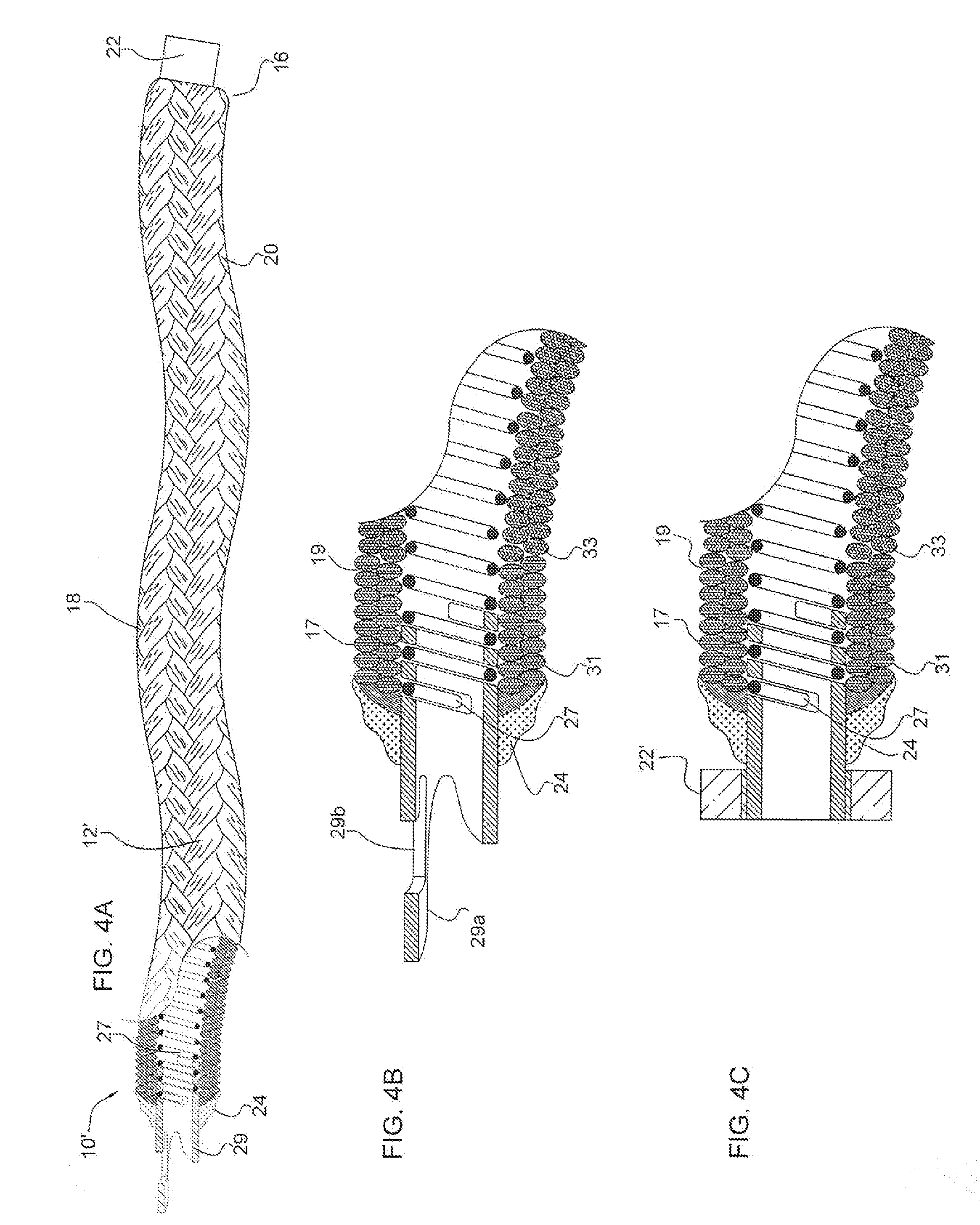 Micrograft for the treatment of intracranial aneurysms and method for use
