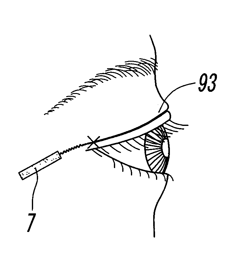 Double eyelid formation tape, method for manufacturing same, and method for forming double eyelid using double eyelid formation tape