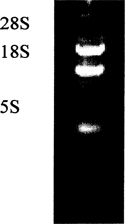 EHEC 0157 shiga-like toxin IIA resisting subunit monoclonal antibody 5F3 light and heavy chain variable region gene and its application