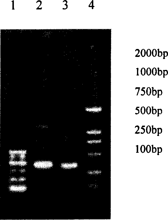 EHEC 0157 shiga-like toxin IIA resisting subunit monoclonal antibody 5F3 light and heavy chain variable region gene and its application