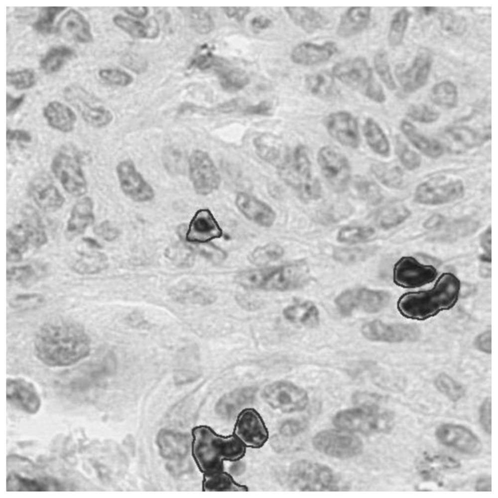 A method and system for segmenting CD3-positive cell nuclei in immunohistochemical pathological images