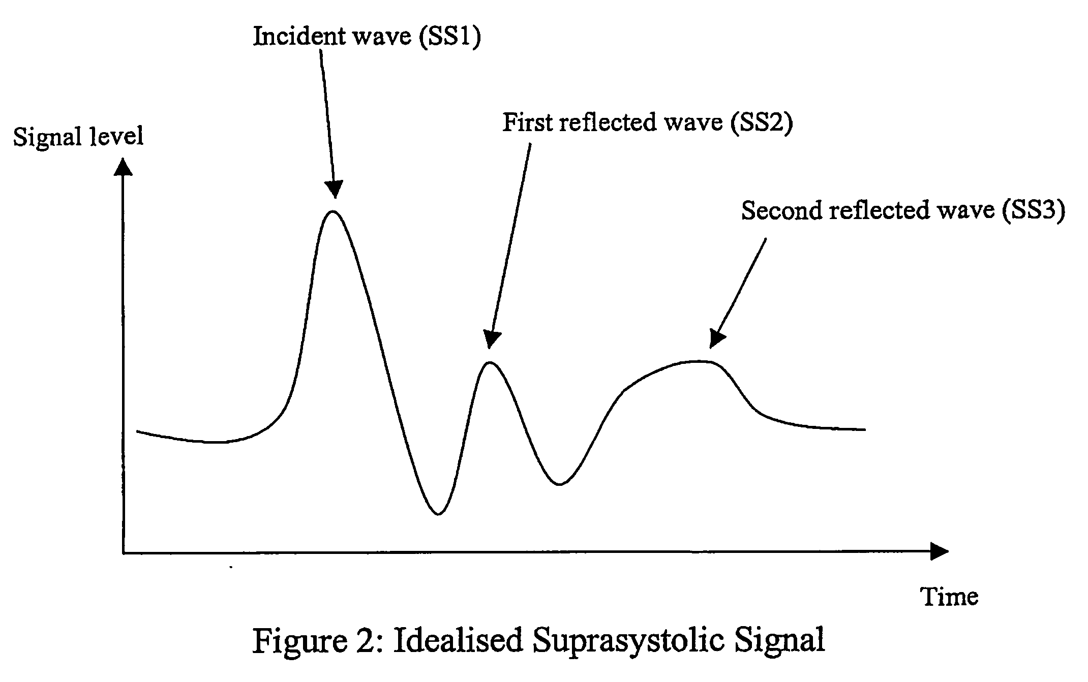 Non-invasive measurement of suprasystolic signals