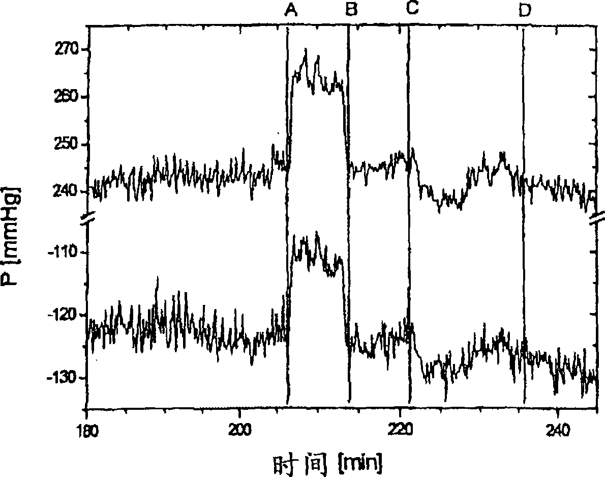 Method and device for monitoring an extracorporeal blood circuit