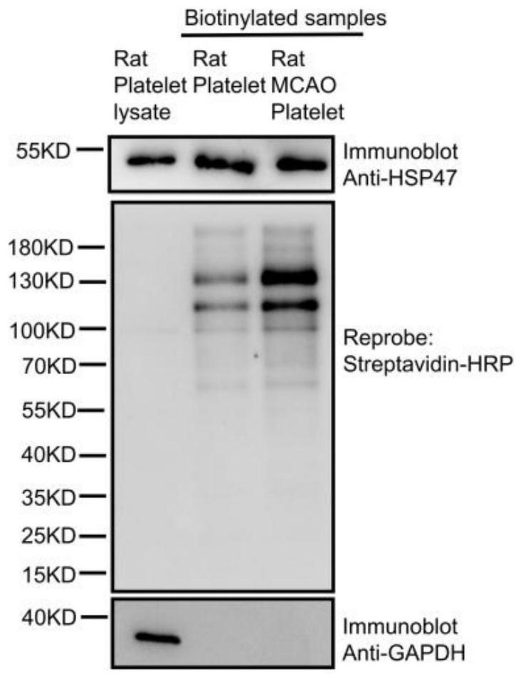 Application of compound in preparation of antithrombotic drugs