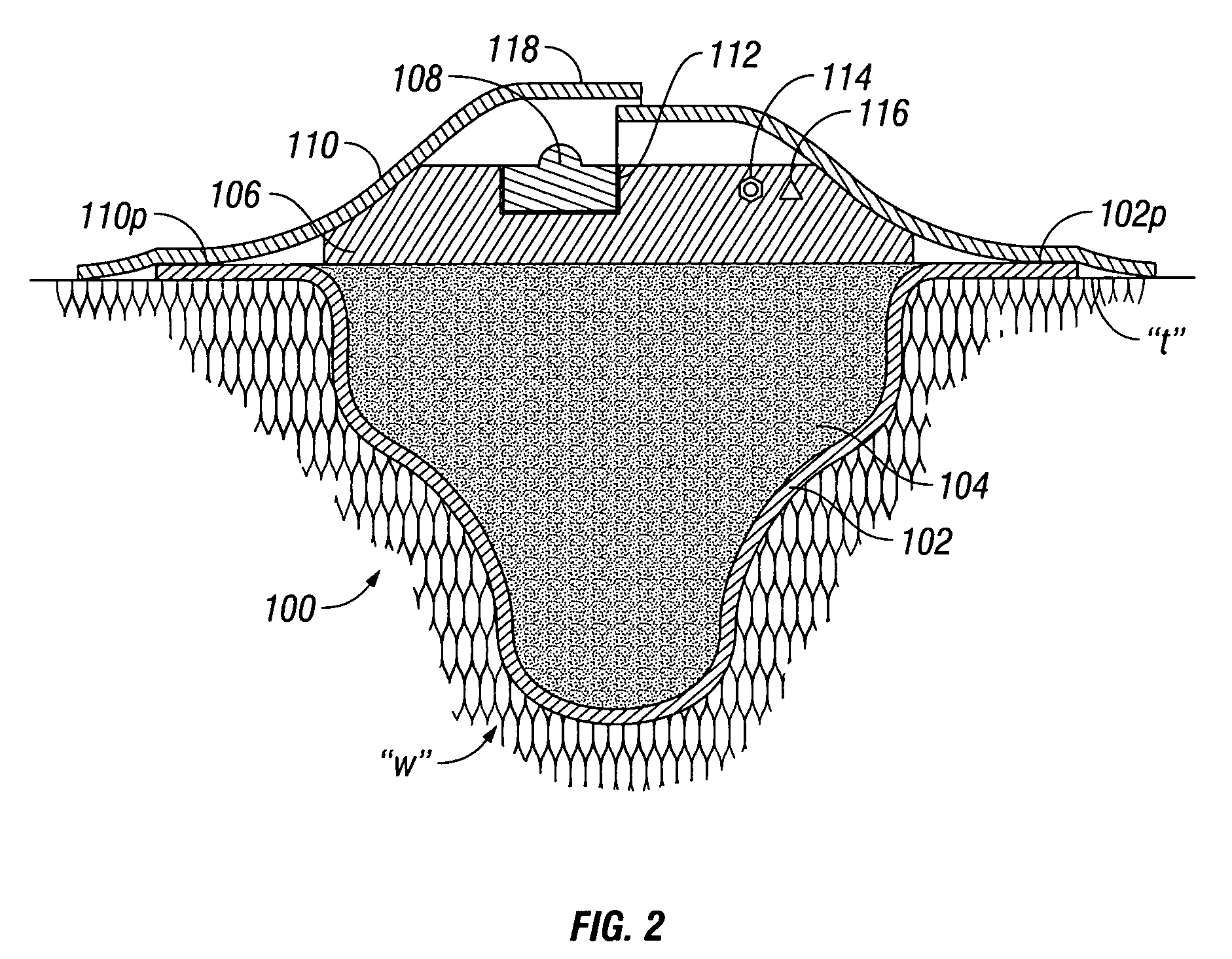 Self contained wound dressing with micropump