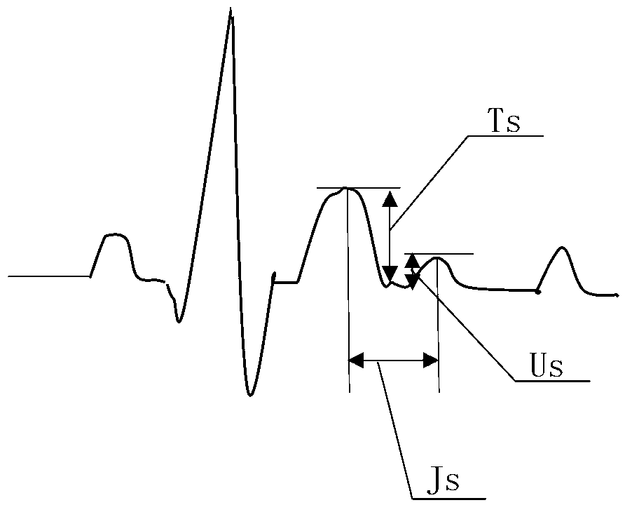 Method for quantitatively evaluating cardiac function based on electrocardiogram U waves and T waves and device thereof