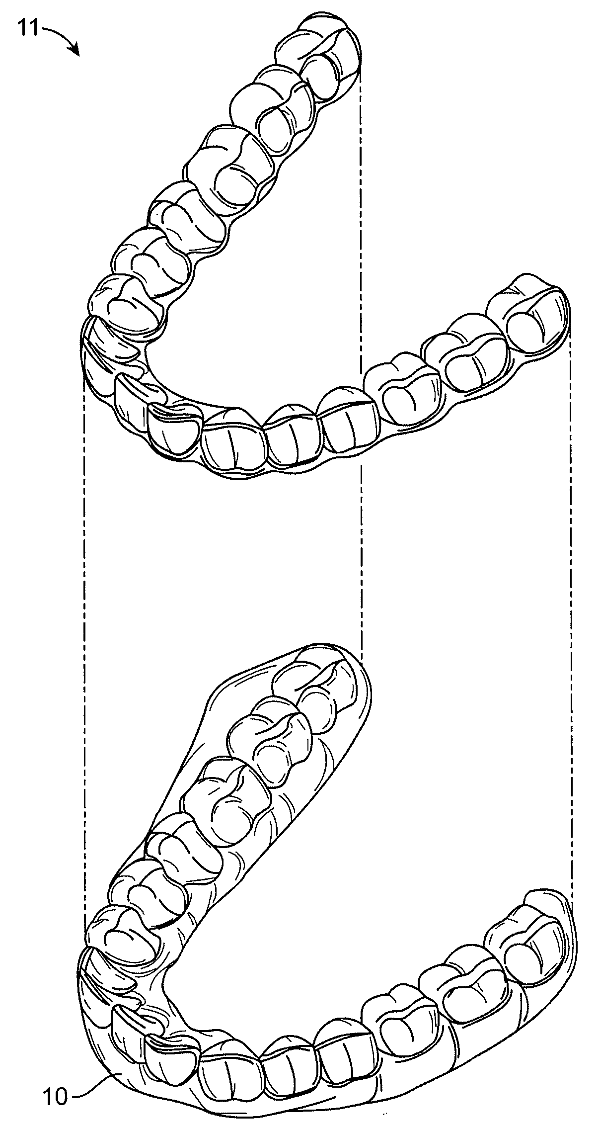 Orthodontic repositioning appliances having improved geometry, methods and systems
