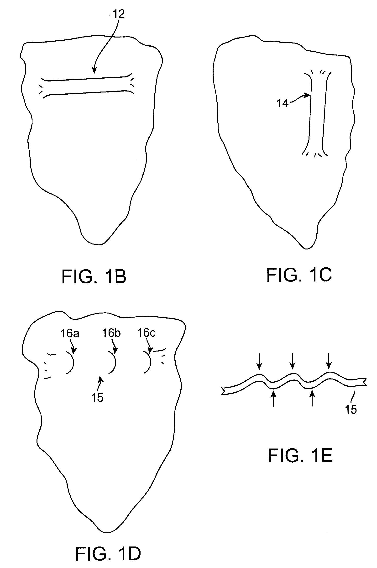 Orthodontic repositioning appliances having improved geometry, methods and systems