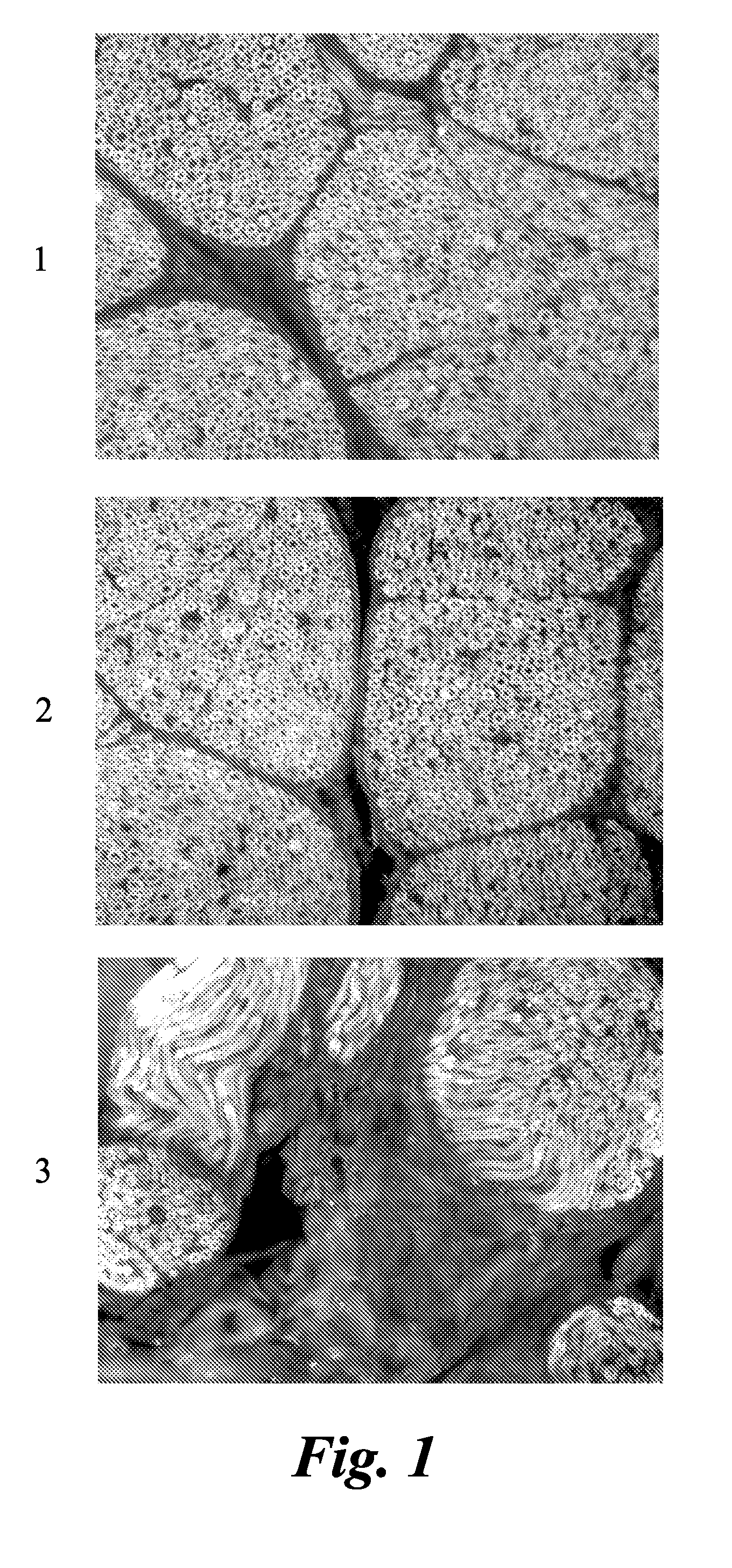Agents and methods for the imaging of myelin basic protein