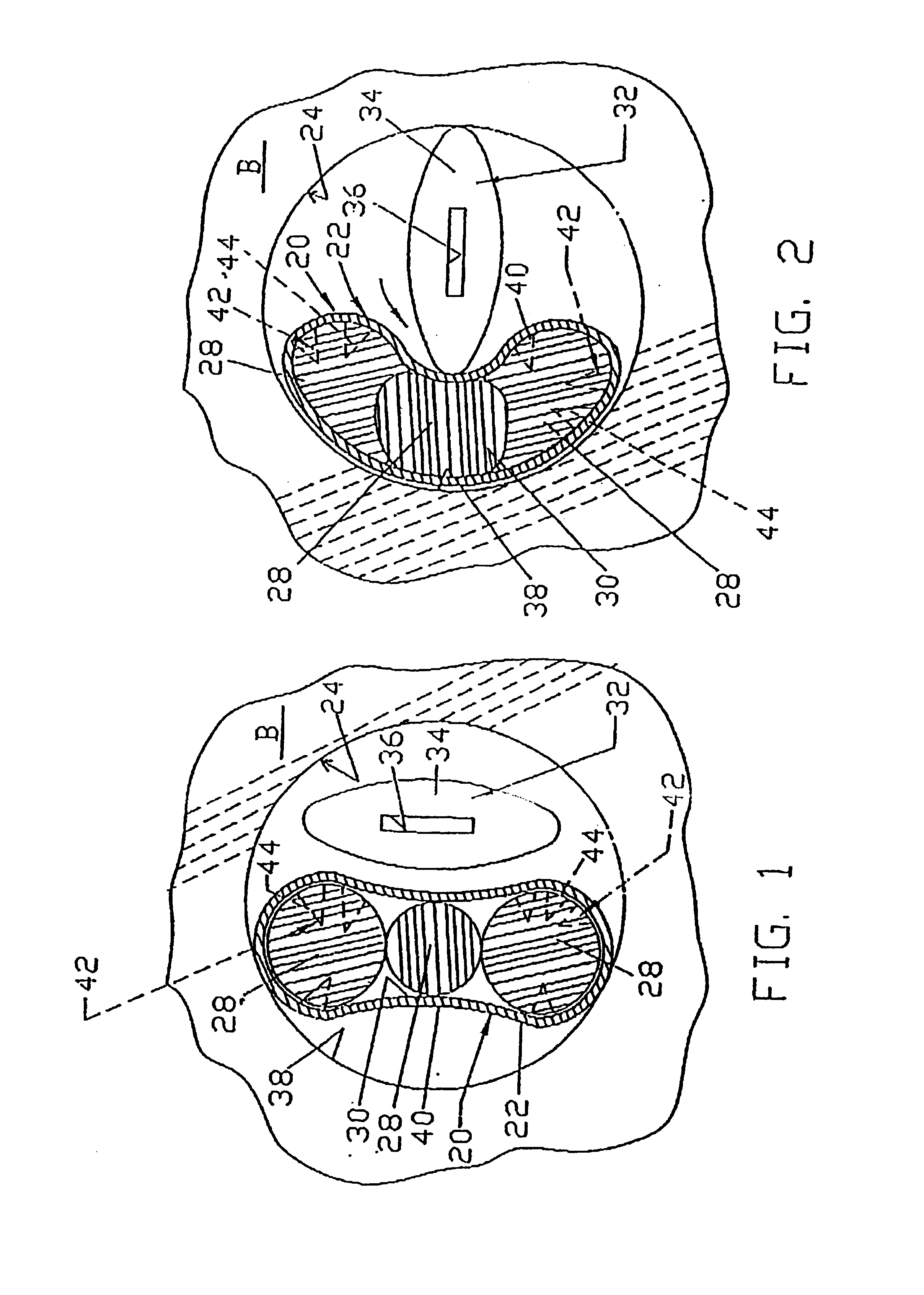 Graft ligament anchor and method for attaching a graft ligament to a bone