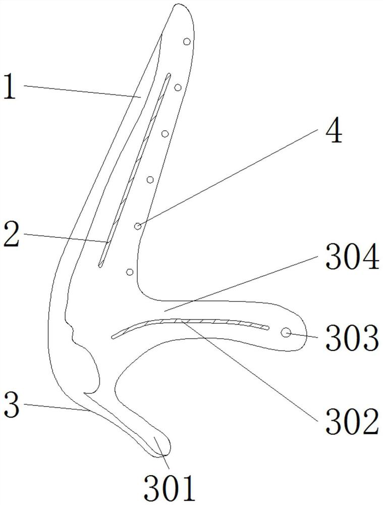 Degradable nose prosthesis based on 3d printing