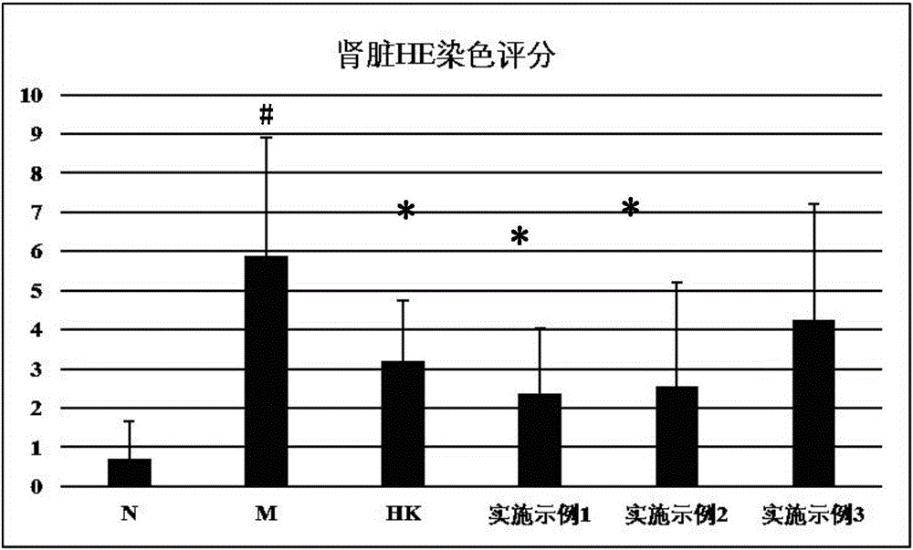 Traditional Chinese medicine composition having efficacy of preventing and treating chronic renal failure and preparation method and application thereof