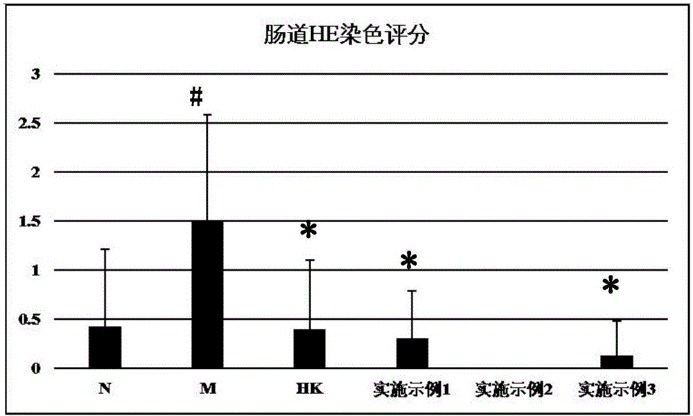 Traditional Chinese medicine composition having efficacy of preventing and treating chronic renal failure and preparation method and application thereof