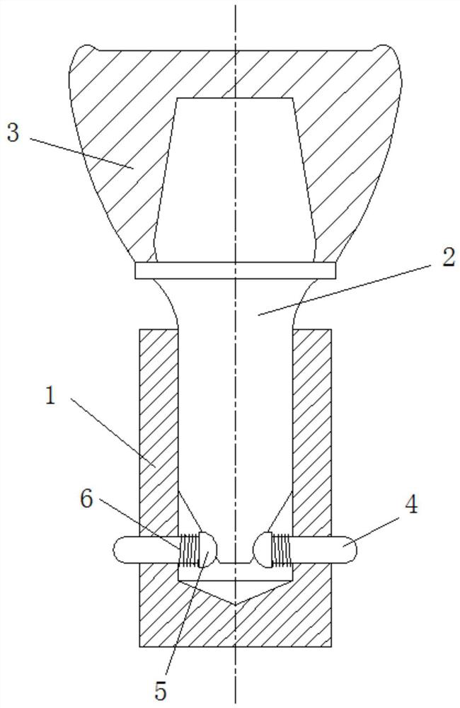 Dental implant system