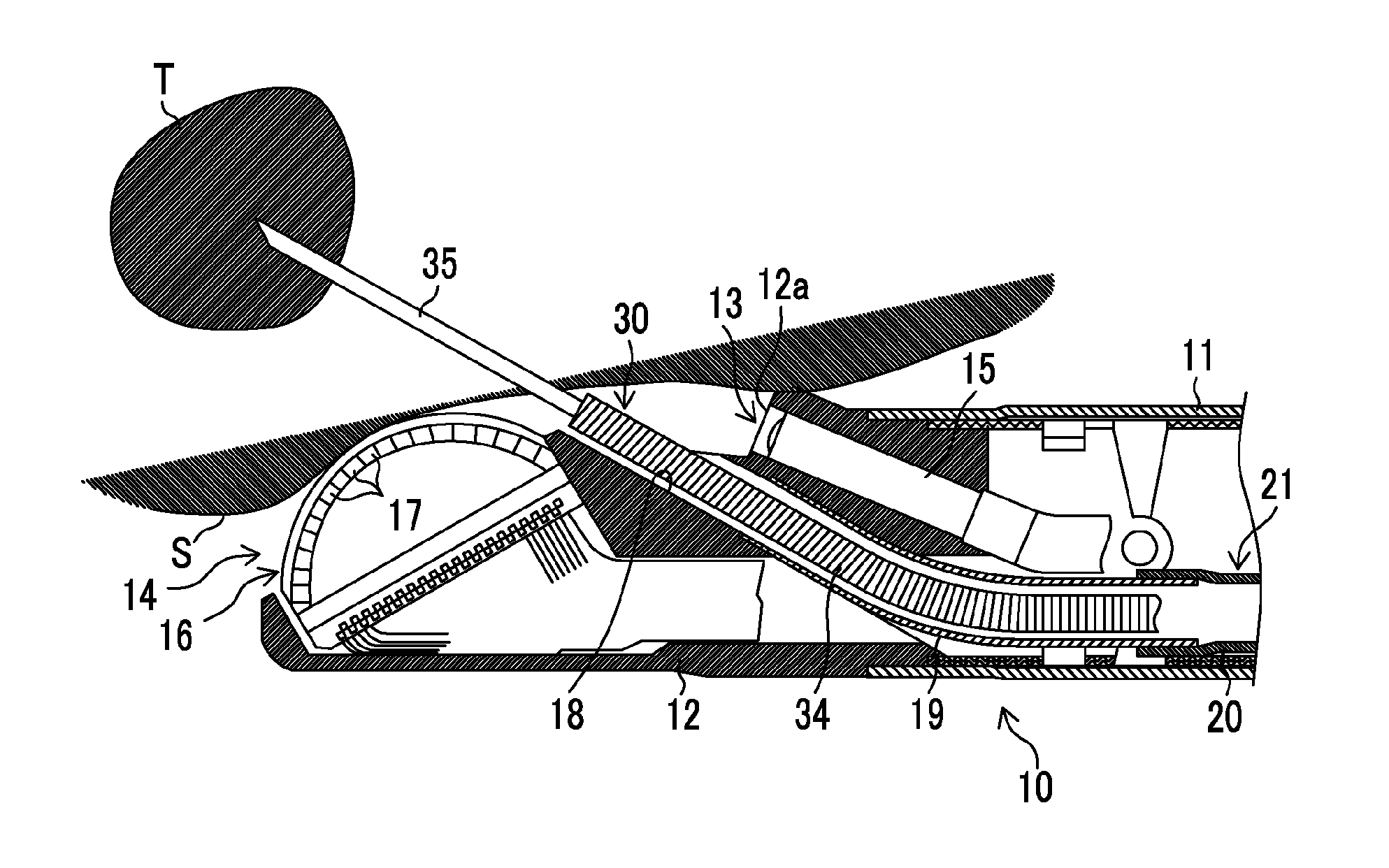 Tissue harvesting apparatus