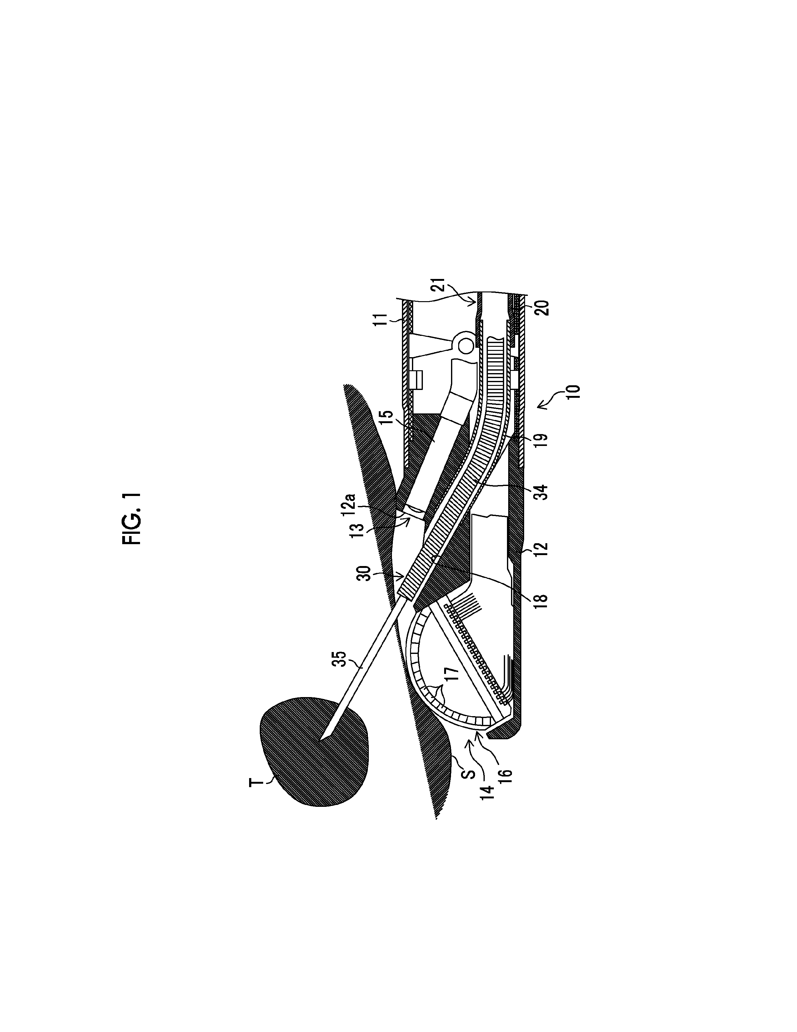 Tissue harvesting apparatus