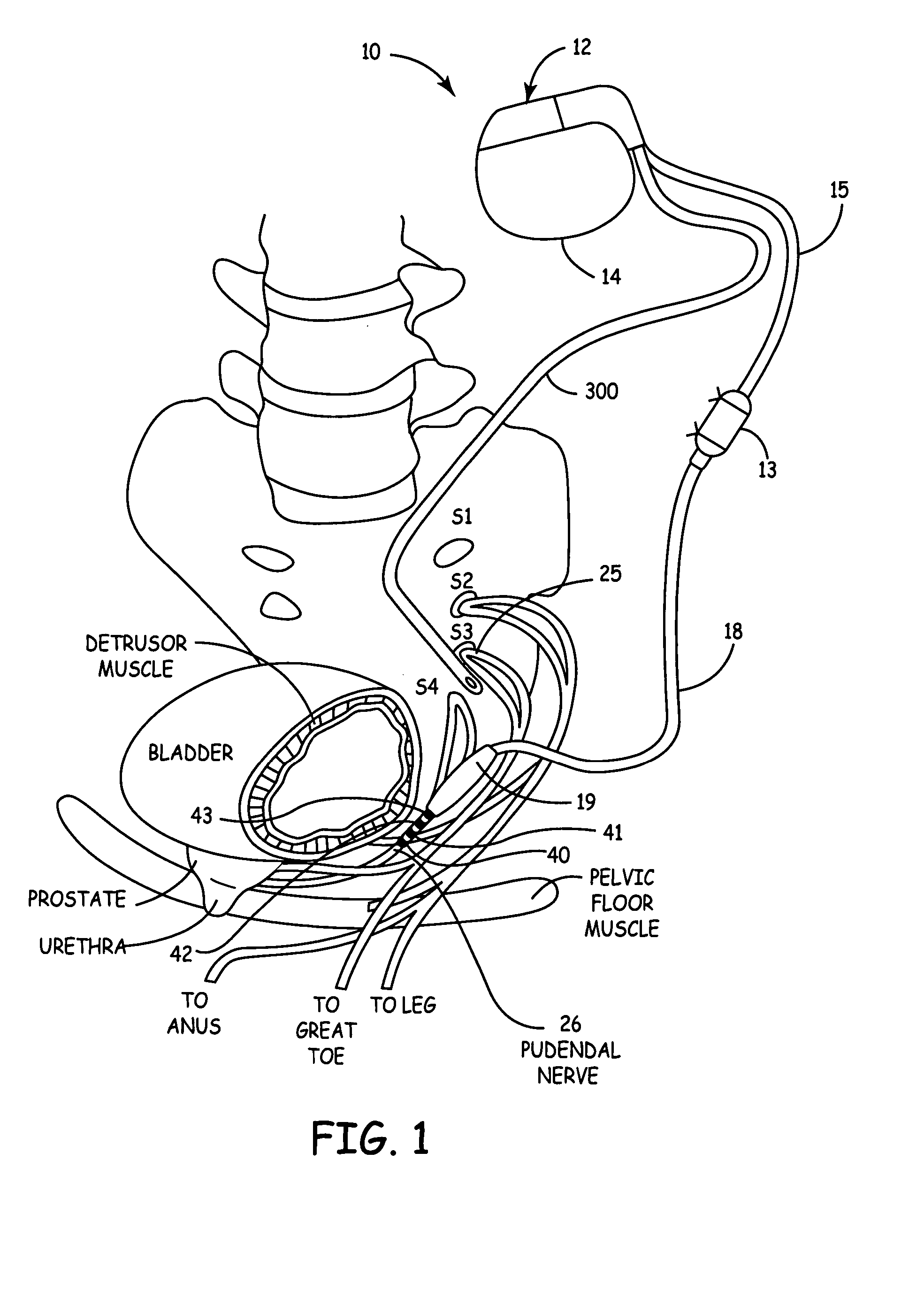 Method, system and device for treating disorders of the pelvic floor by delivering drugs to various nerves or tissues