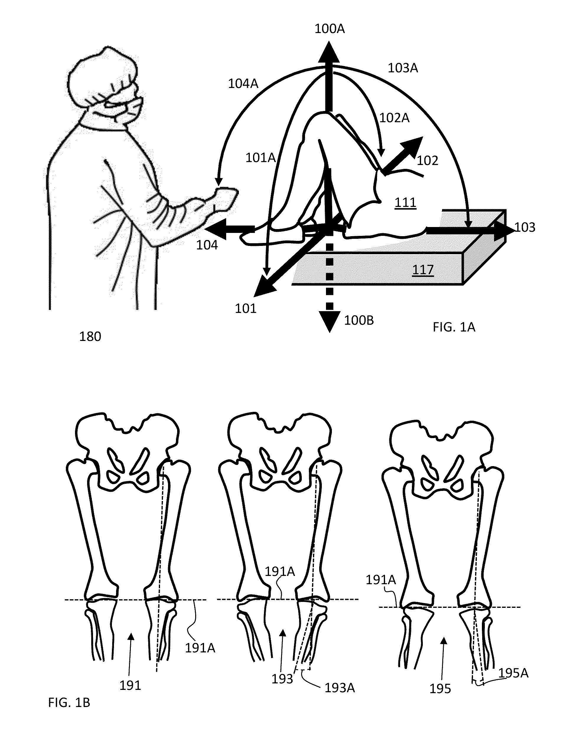 System and method for measuring muscular-skeletal alignment to a mechanical axis