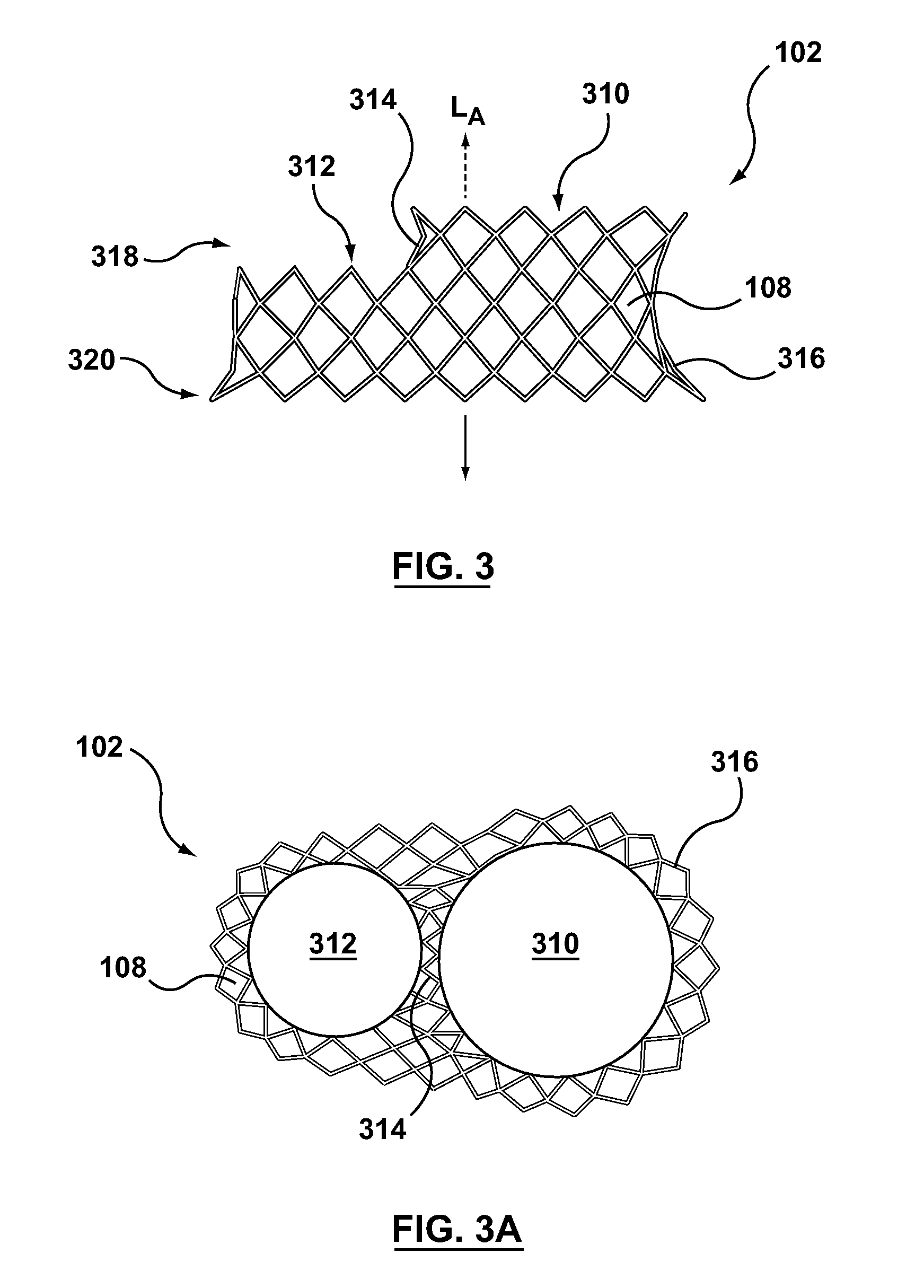 Dual Valve Prosthesis for Transcatheter Valve Implantation