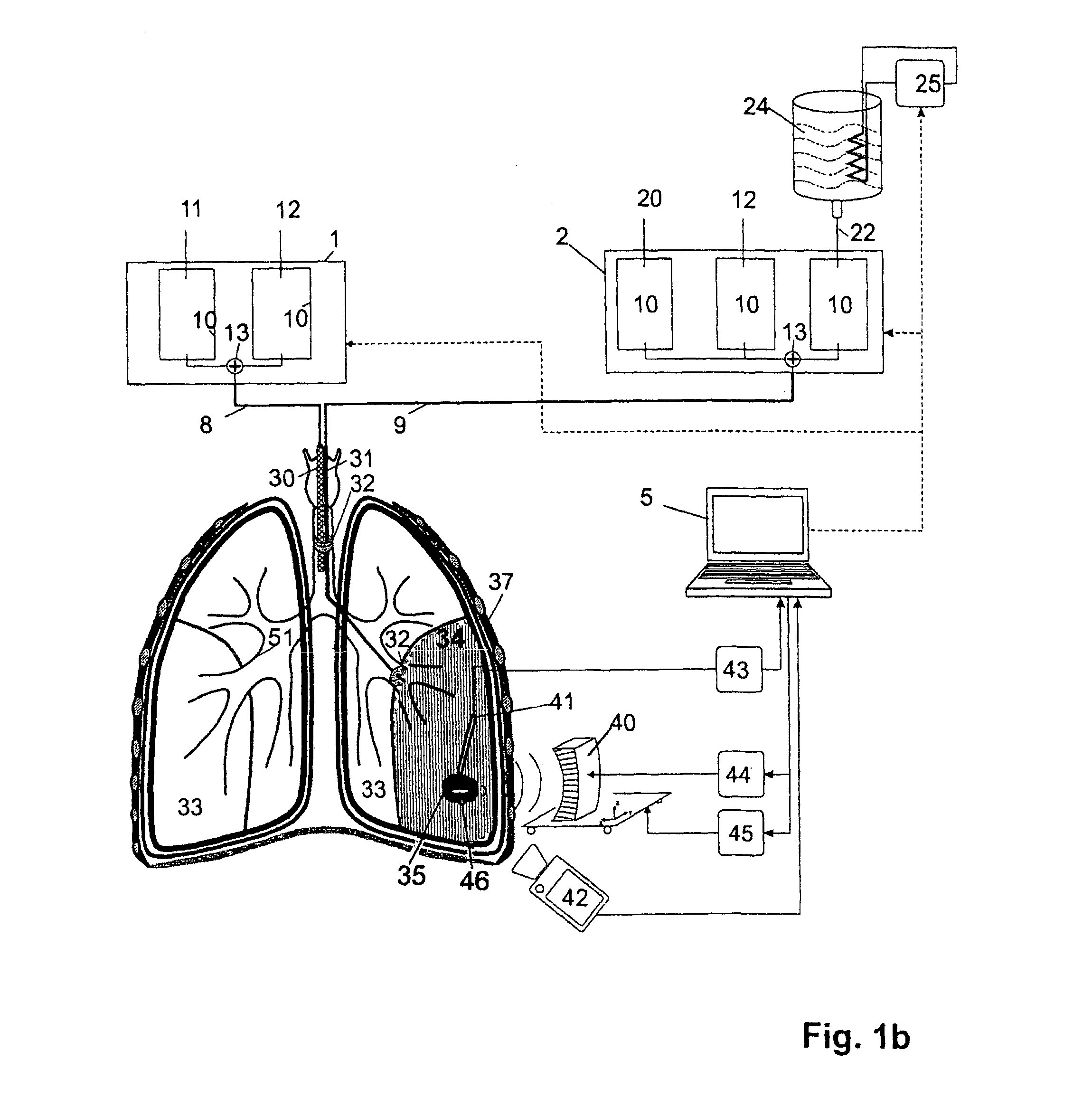 ARRANGEMENT AND METHOD FOR THE IN-VITRO and IN-VIVO TREATMENT OF BRONCHIAL TUMORS