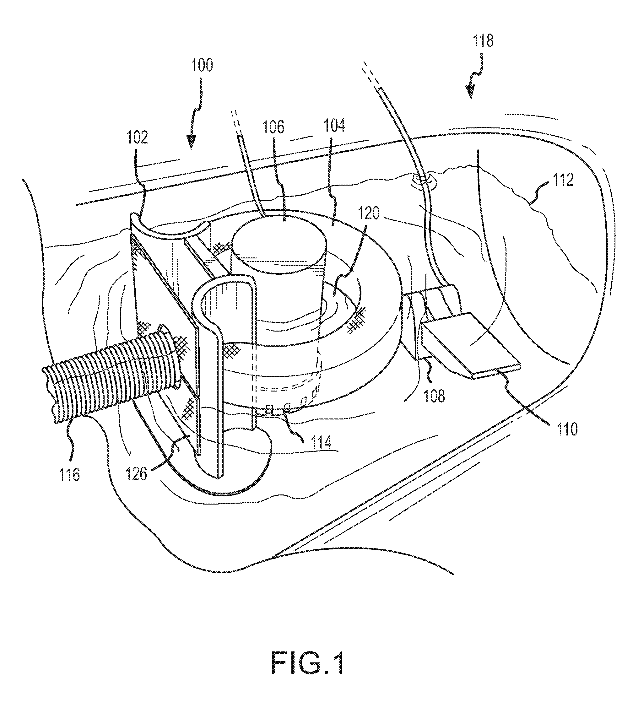 Water pollution prevention and remediation apparatus