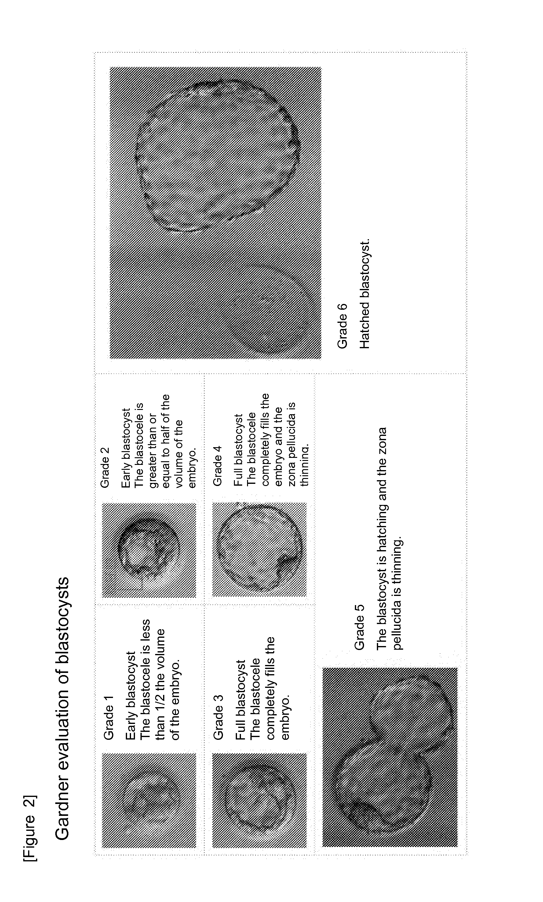 Method for evaluating human blastocyst by norepinephrine level in blastocyst culture solution