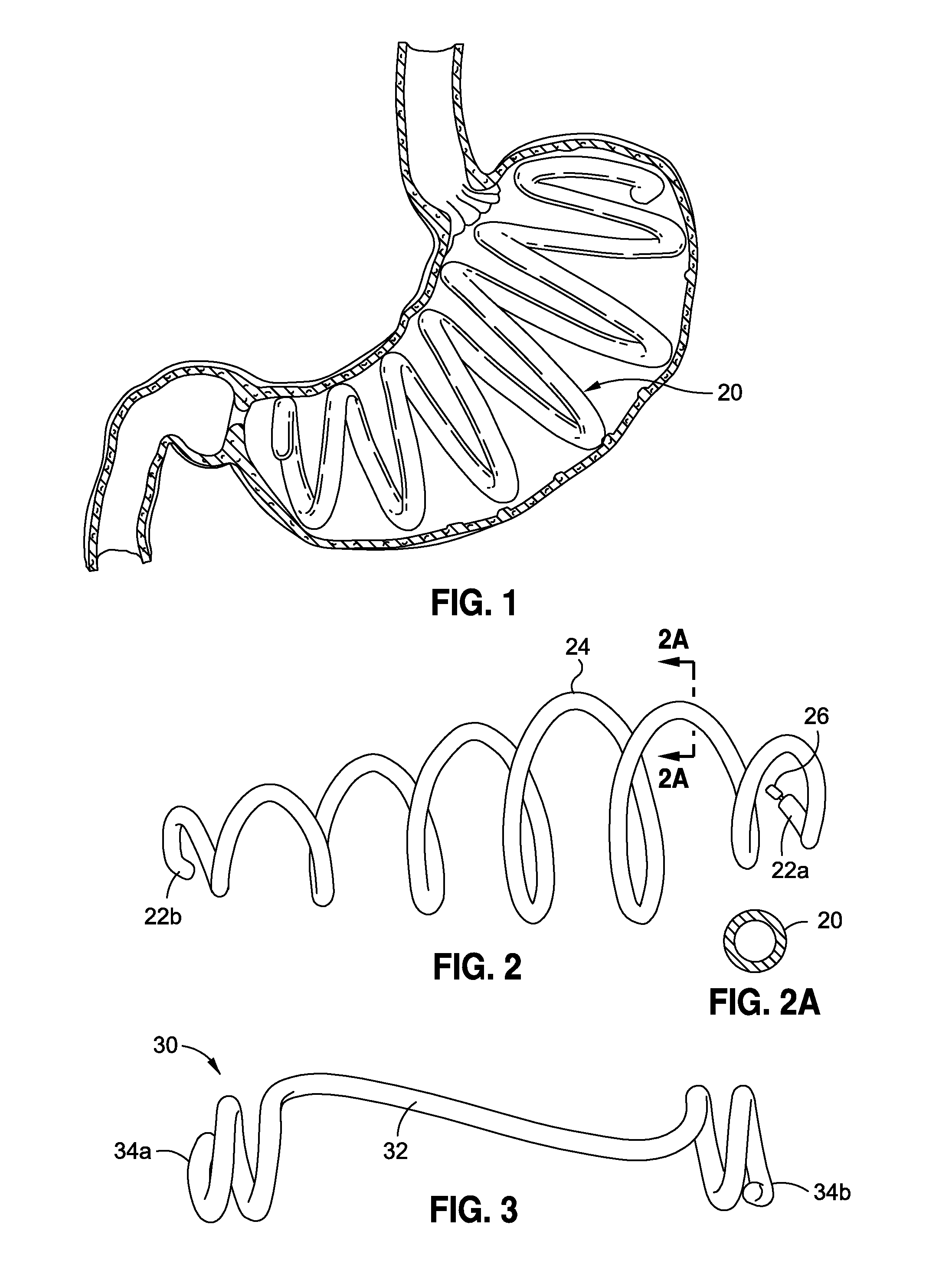 Non-inflatable gastric implants and systems